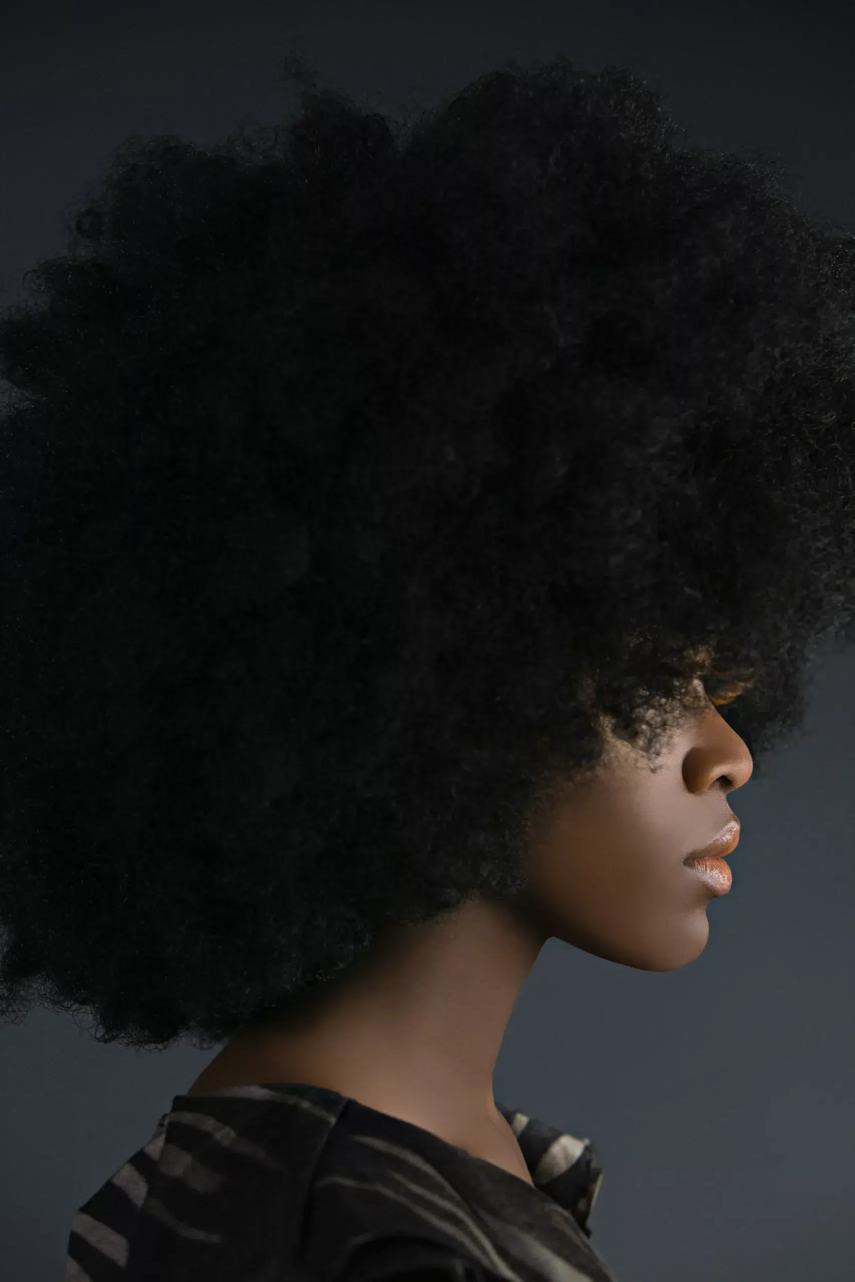 La greffe de cheveux chez les sujets Afro-américains en Medecine Esthetique Clinique Rivoli Massena 1